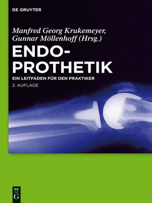 cover image of Endoprothetik